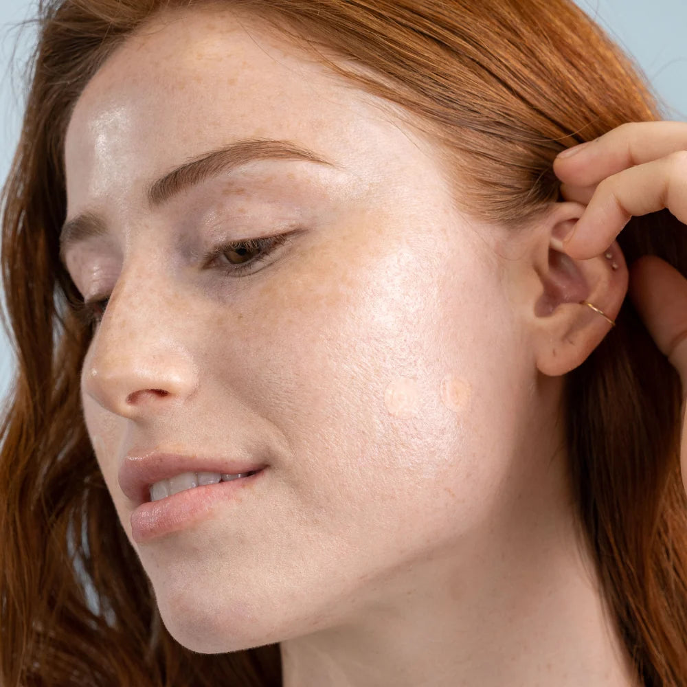 Clean Skin Club Derma Dot invisible pimple patches