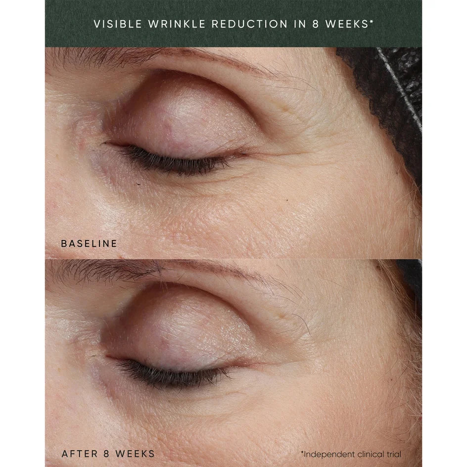 Irene Forte Phytomelatonin Rejuvenation Eye Cream
